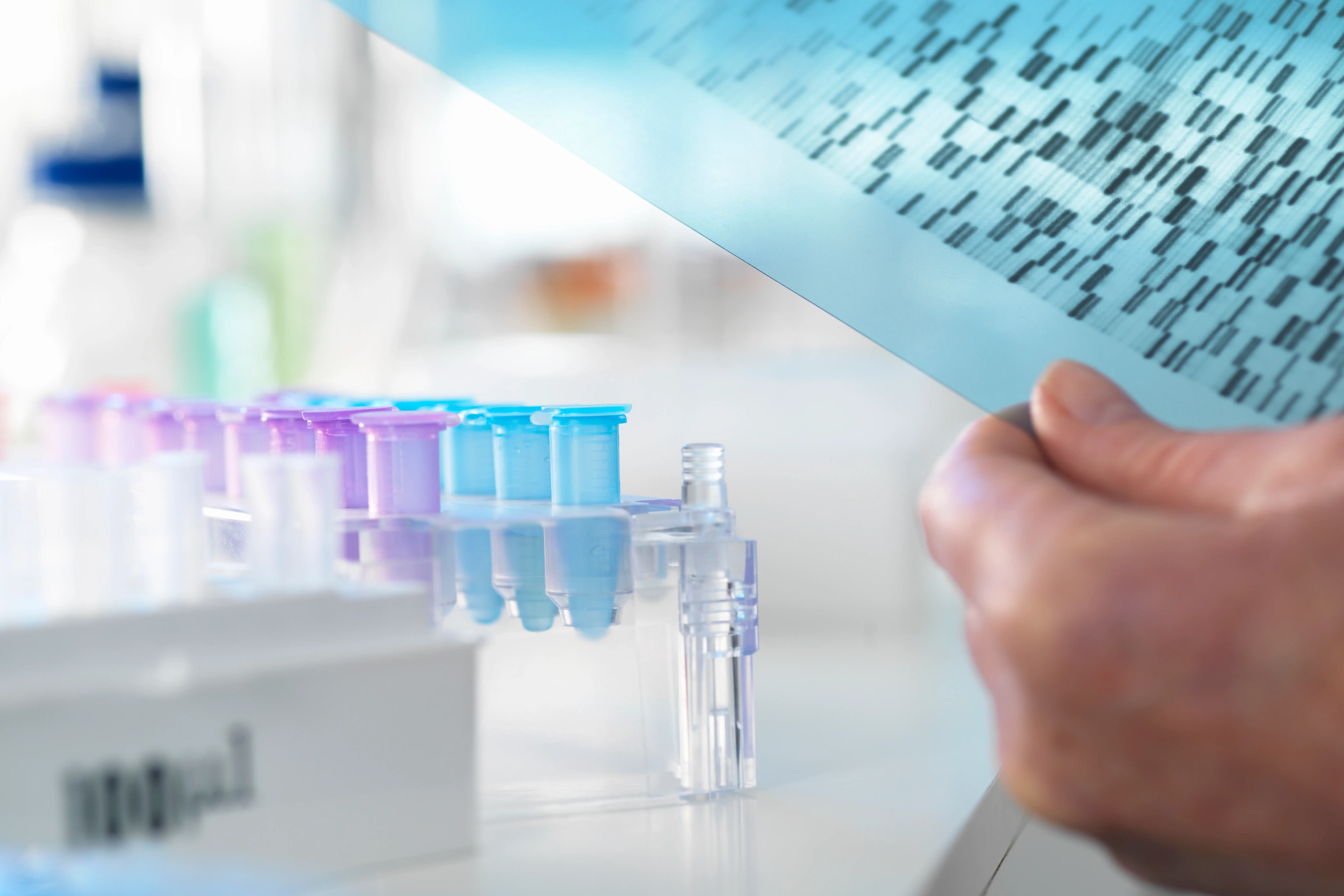 Revolutionizing Lab Diagnostics: The Age of Automation